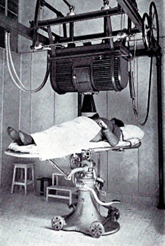 Dispositif de radiothérapie